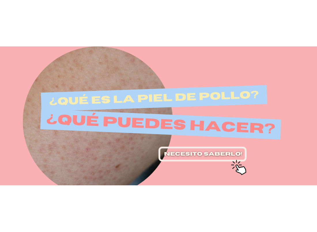 ¿Qué es la piel de pollo o la queratosis pilar?