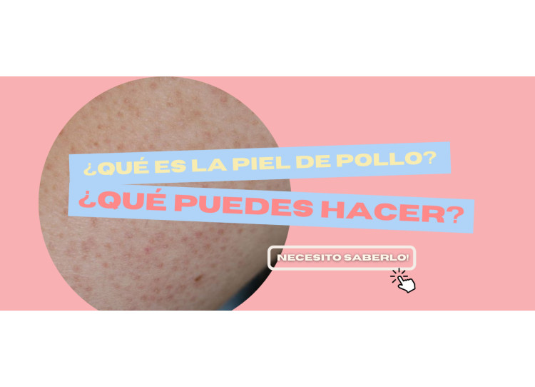 ¿Qué es la piel de pollo o la queratosis pilar?