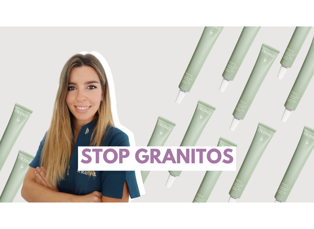 Stop Granitos