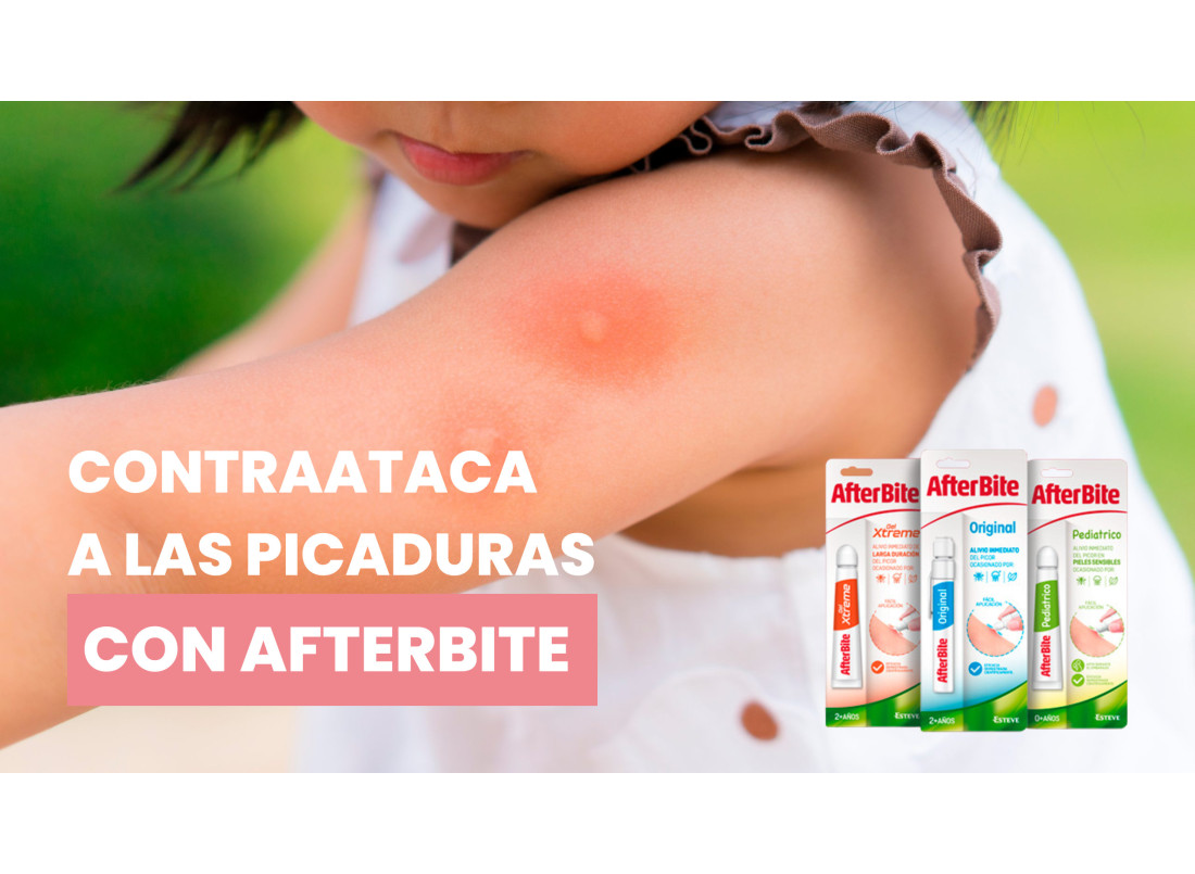 ¿Qué hacer si te pica un mosquito? ¡Los mejores post pica!